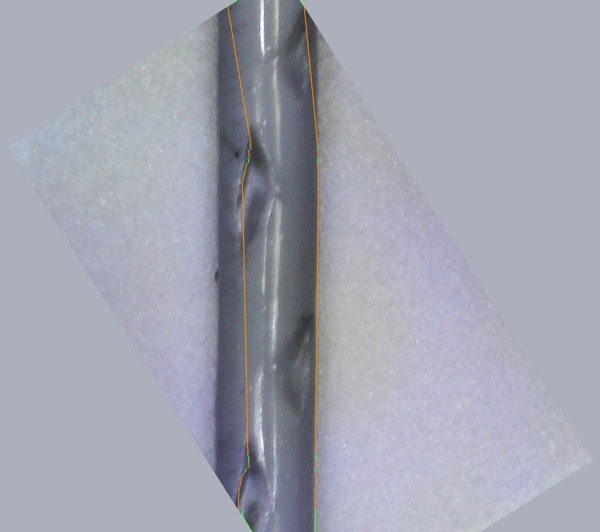 String surface under the microscope